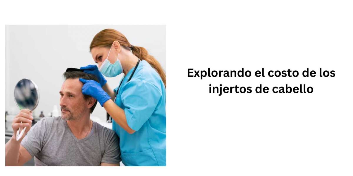 Explorando el costo de los injertos de cabello