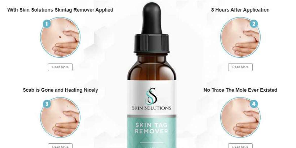 Skin Solutions Skin Tag Remover Safe And 100% Effective Serum!