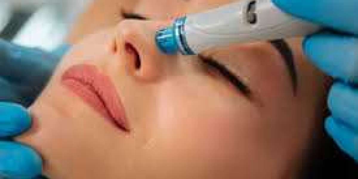 The Ultimate Guide to Hydrafacial in Dublin: Benefits and Treatment Overview