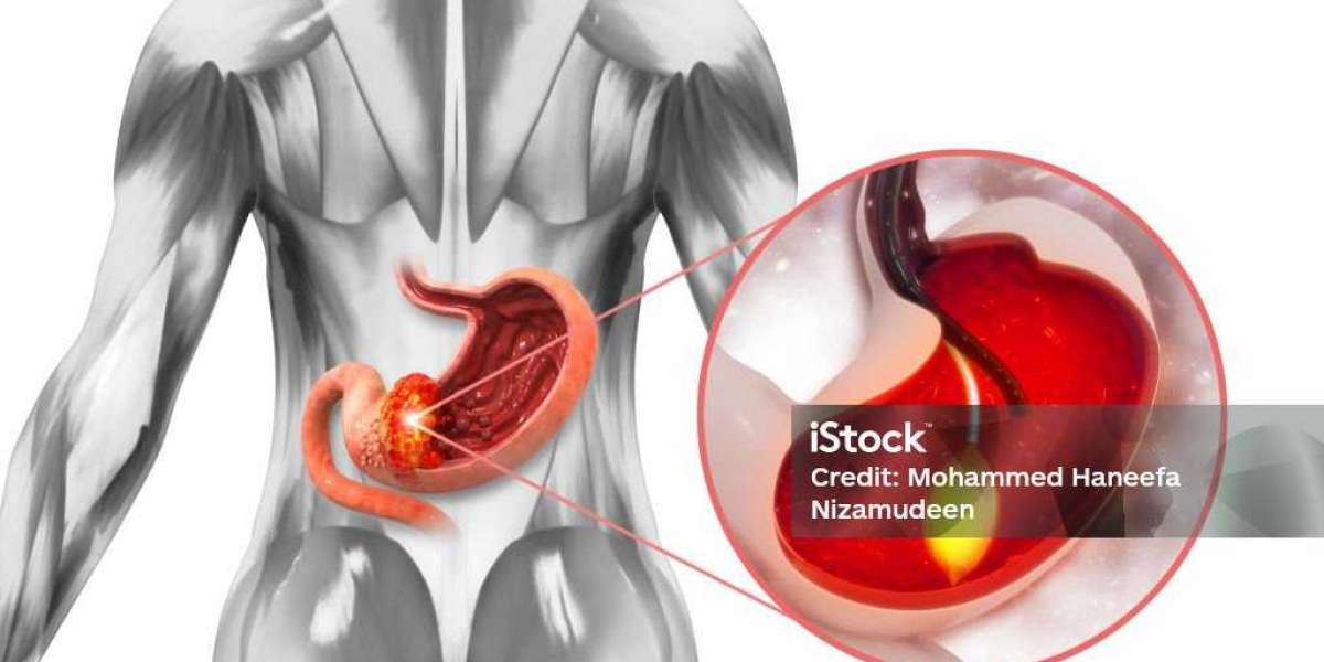 Use of Fenbendazole in Treating Pinworm Infection