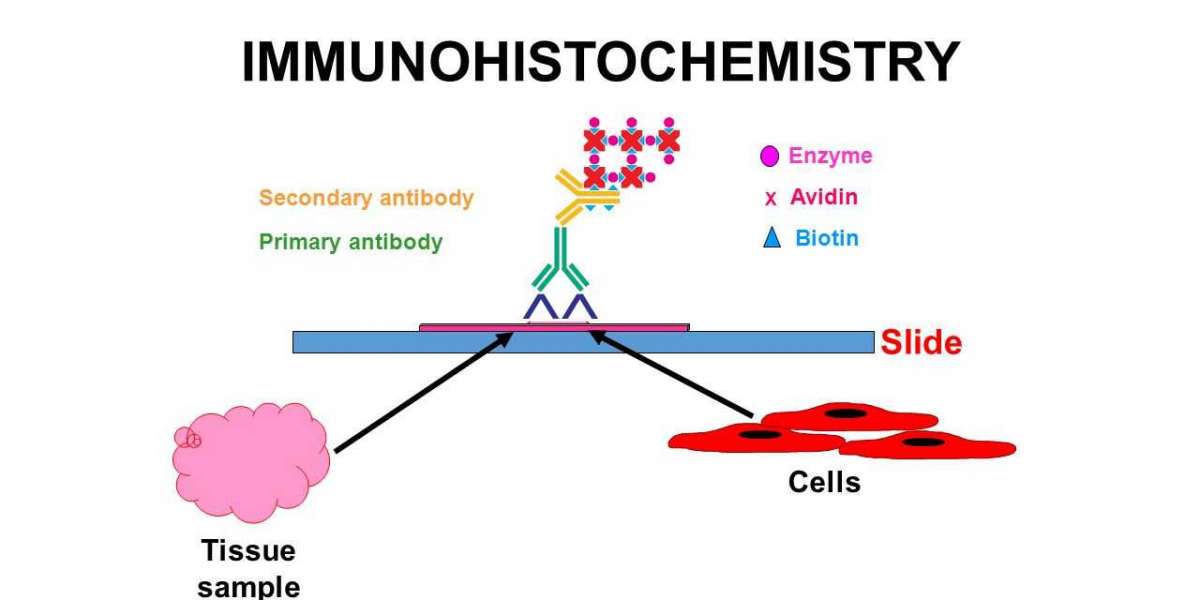 Immunohistochemistry Market Global Industry Analysis, Size, Share, Growth, Trends, Regional Outlook, and Forecast 2024-2