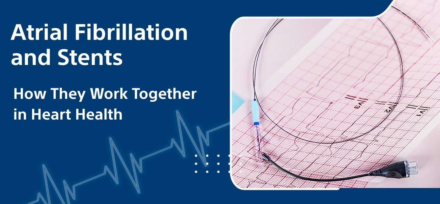 Atrial Fibrillation and Stents: How They Work Together in Heart Health - It Flex News | Business | Tech | Sports