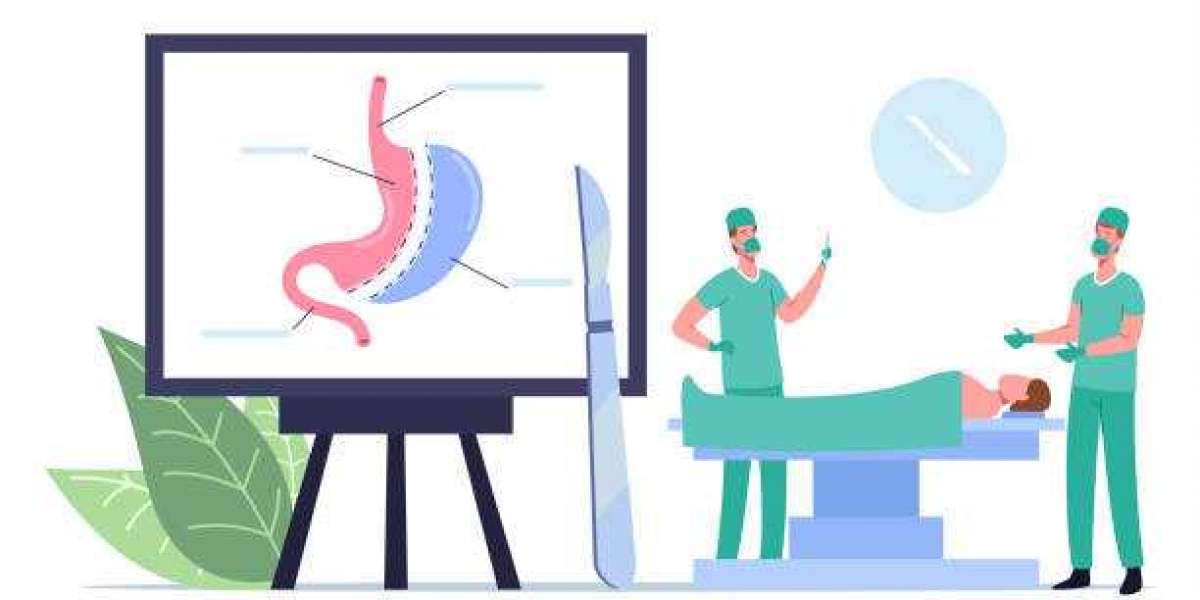 Laparoscopic surgery