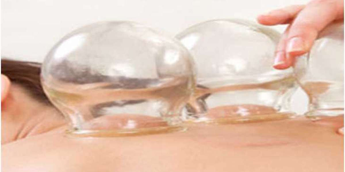 How Cupping Therapy Benefits Athletes: Reducing Muscle Tension Naturally