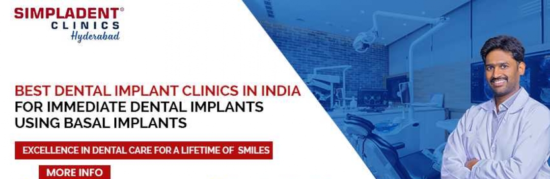 Full Mouth Dental Implant Surgery in Hyderabad Cover Image