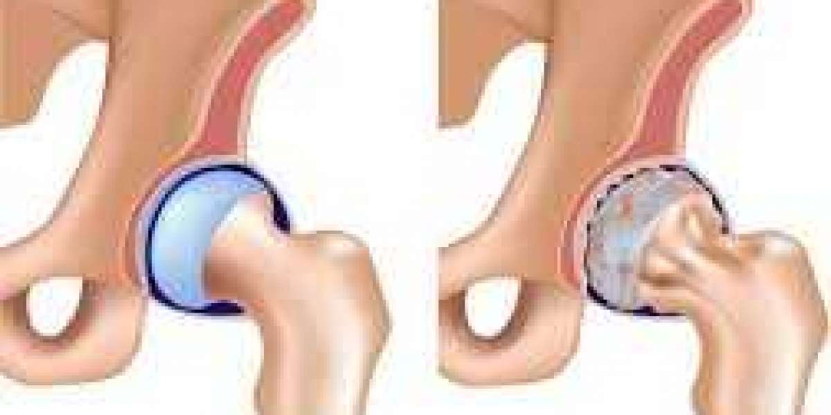 What Are the 7 Diagnostic Criteria for Rheumatoid Arthritis (RA)?