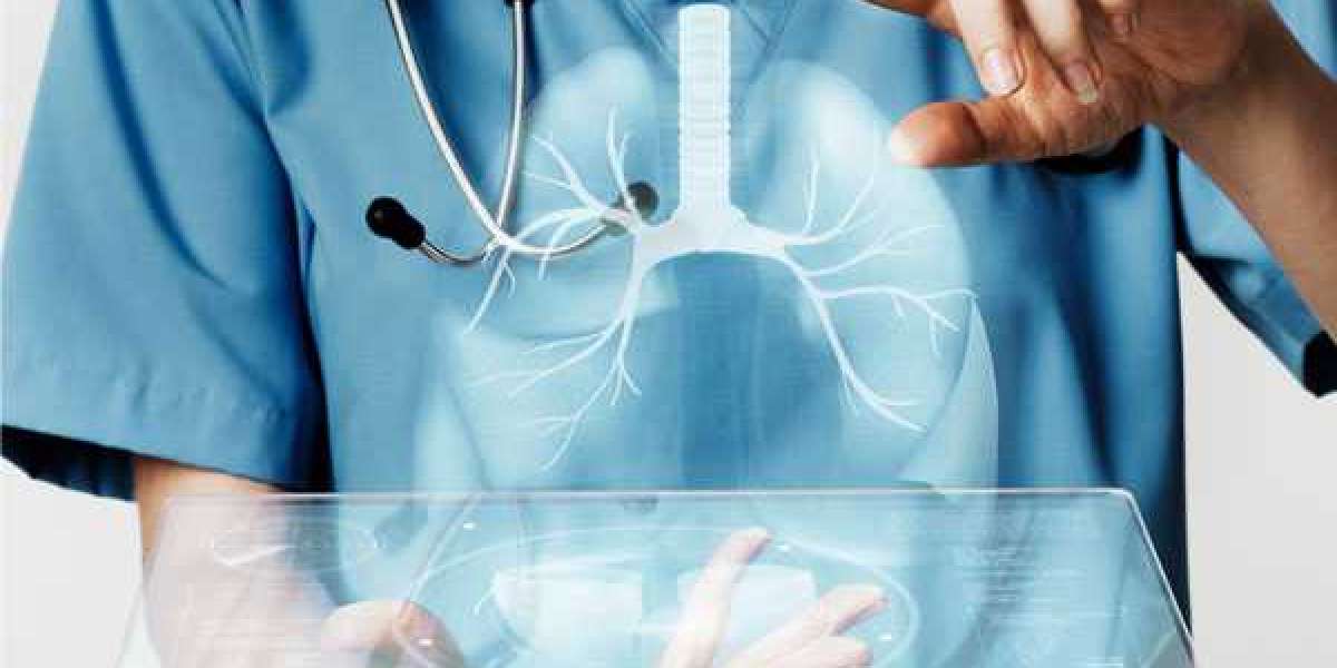 Do You Need a Lung Cancer Specialist? Signs You Shouldn’t Ignore