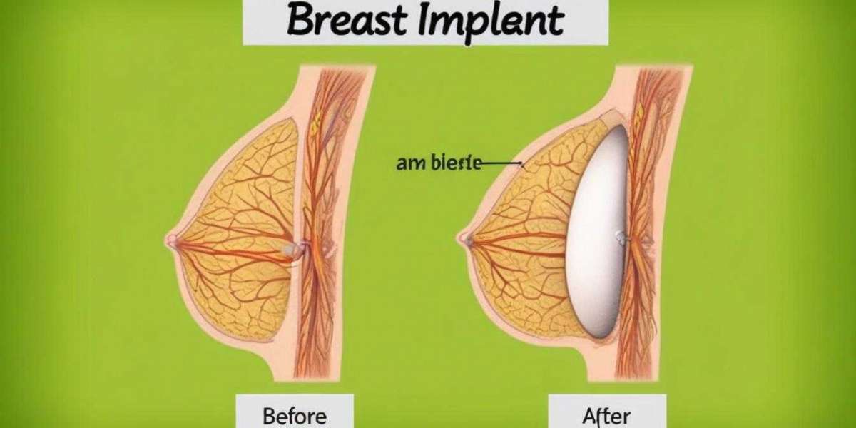 Best Breast Enlargement in Istanbul and Turkey Breast Reduction