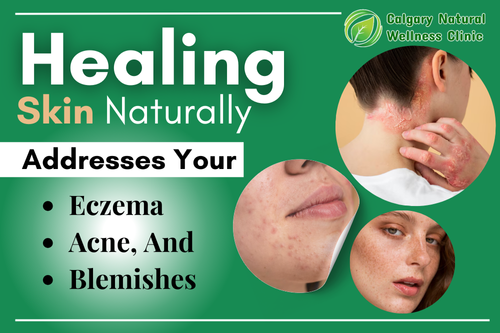 Healing Skin Naturally | Skin Health & Wellness Center Calgary