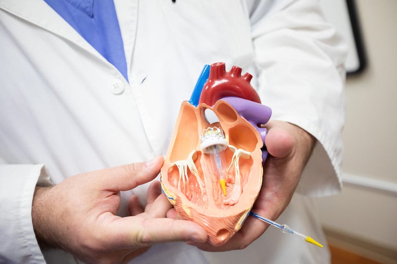 How Aortic Surgery Can Protect Your Heart and Save Your Life | by Aymanzoharan | May, 2025 | Medium