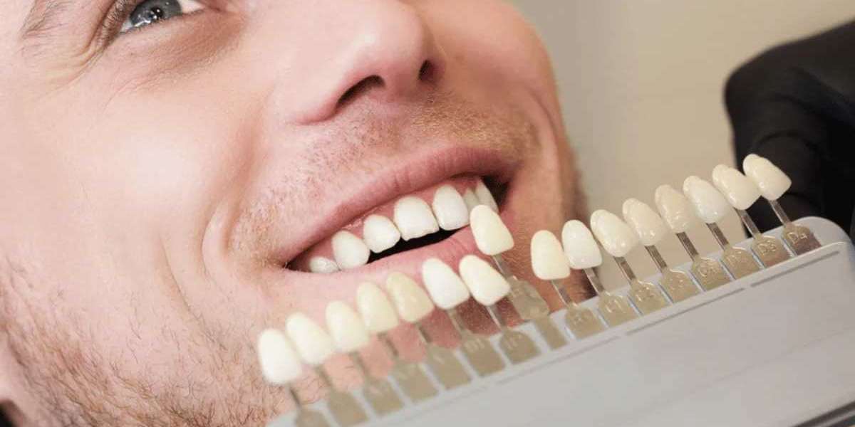 Transform Your Smile with Smile Lounge Dentistry: Mouth Guards and Whitening in Milton