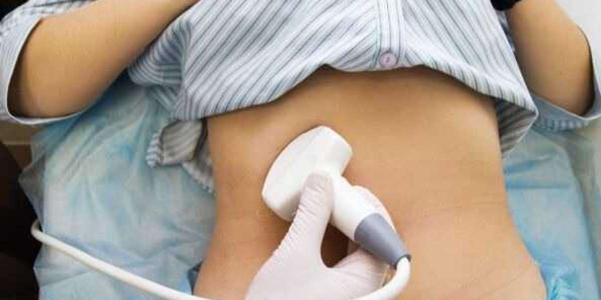 Ultrasound Whole Abdomen Price: Cost, Purpose, and What to Expect