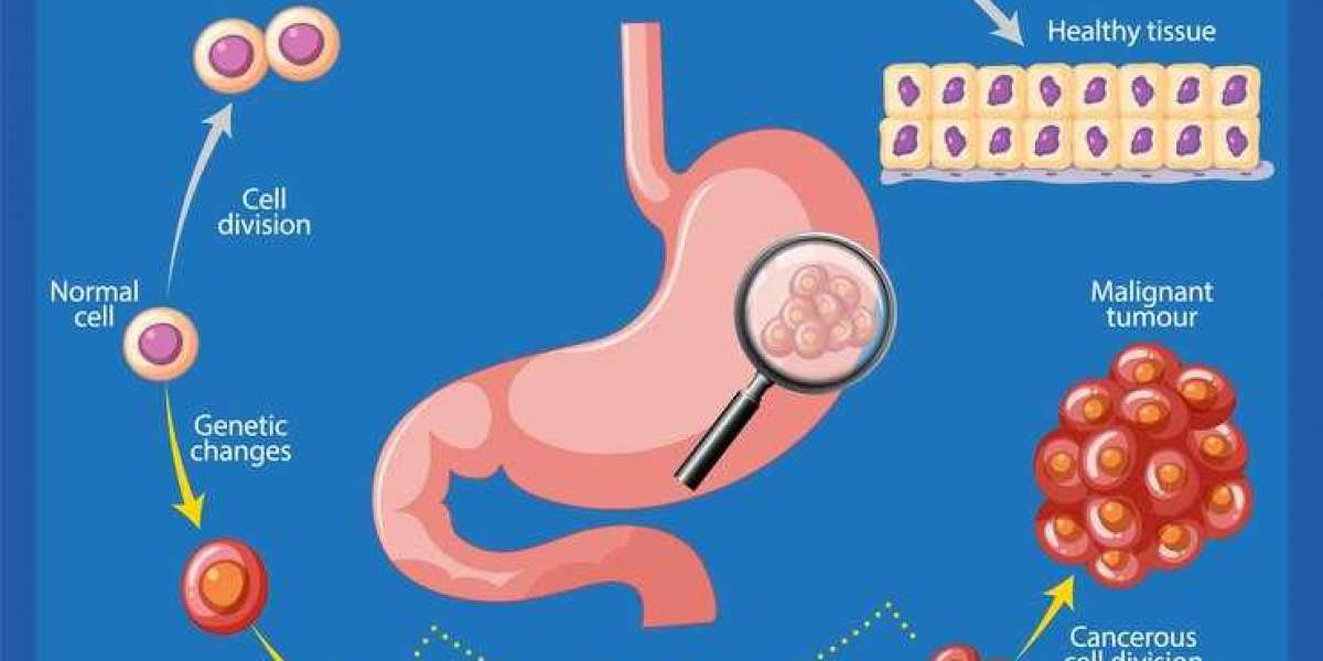 Dr. Bhushan: Leading GI Cancer Surgeon in Bangalore You Can Trust