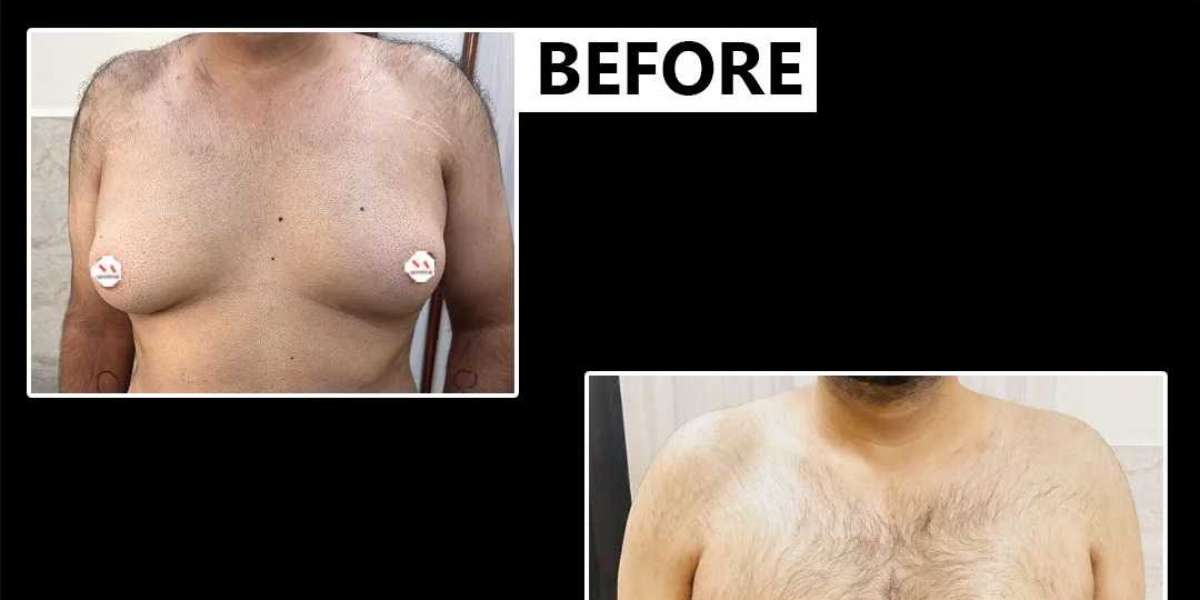 Article Picture