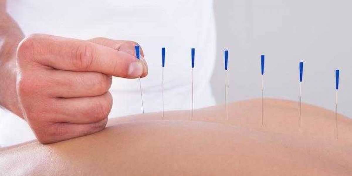 How Dry Needle Therapy in Murfreesboro Can Speed Up Your Recovery