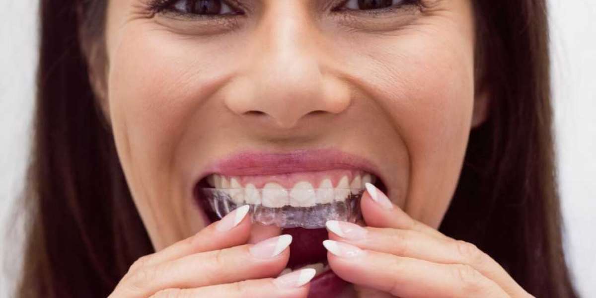 Everything You Need to Know About Teeth Whitening Trays and Dental Whitening Trays