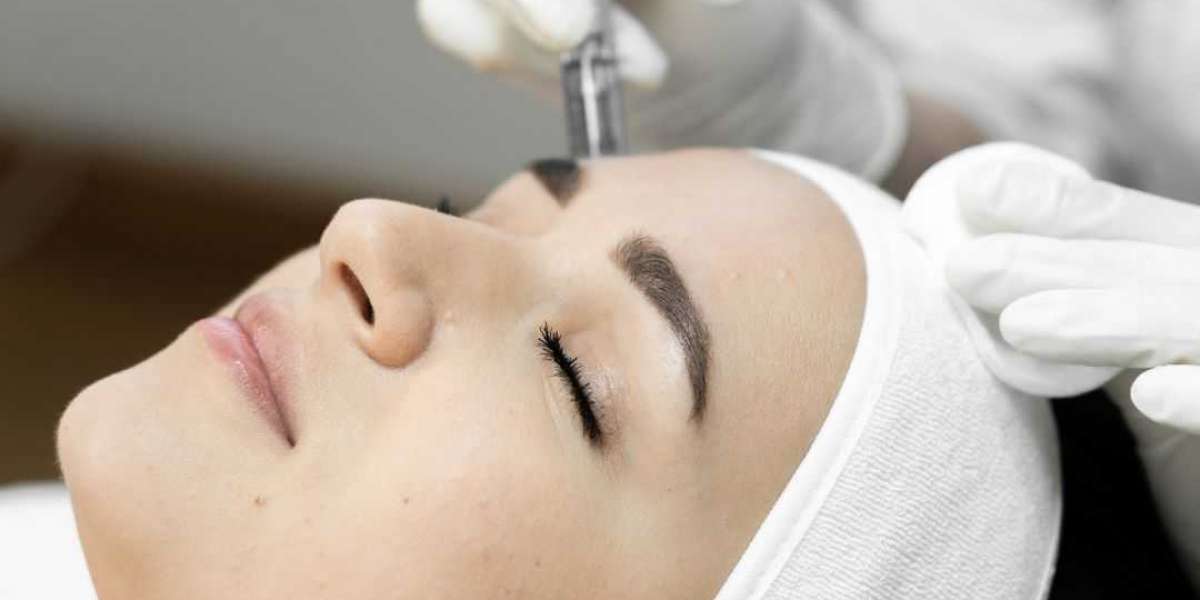 Microneedling Burnaby