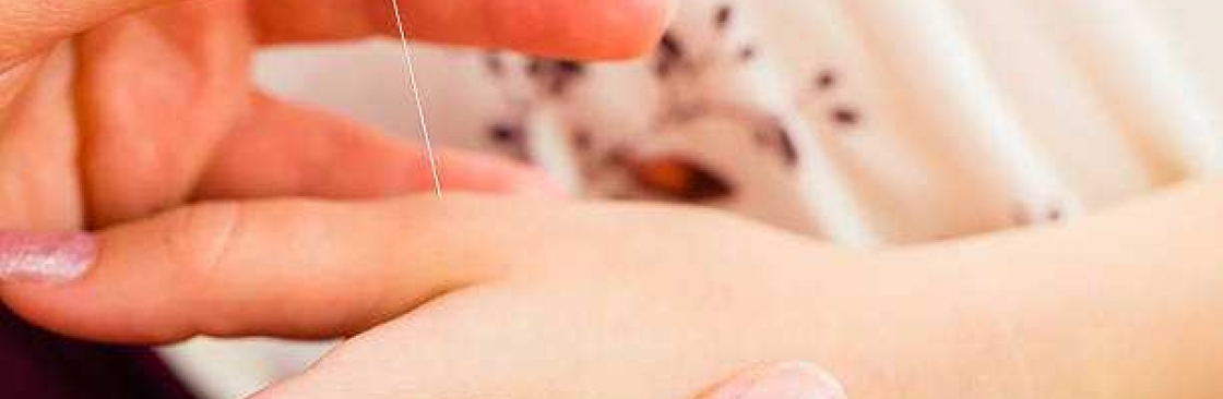 Kerry Rutherford Acupuncture Cover Image