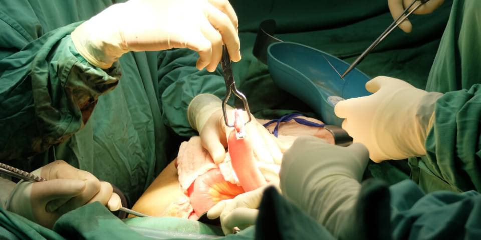 best colorectal surgeon in Bangalore | Top Colorectal treatment in Bangalore - Dr. Bhushan Chiattawadagi