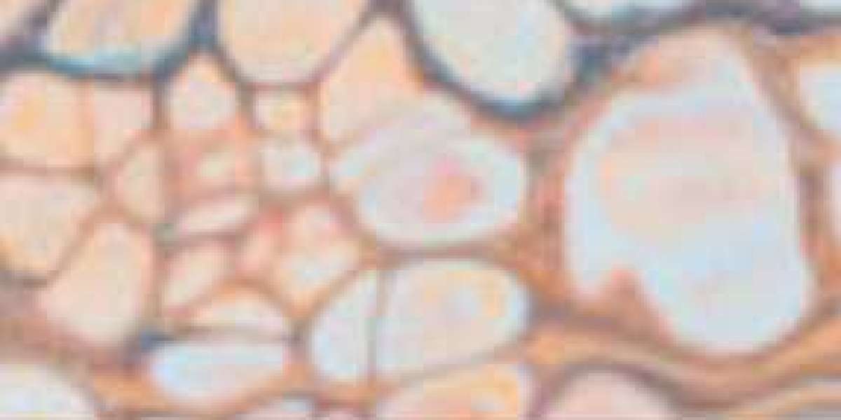 Article Picture