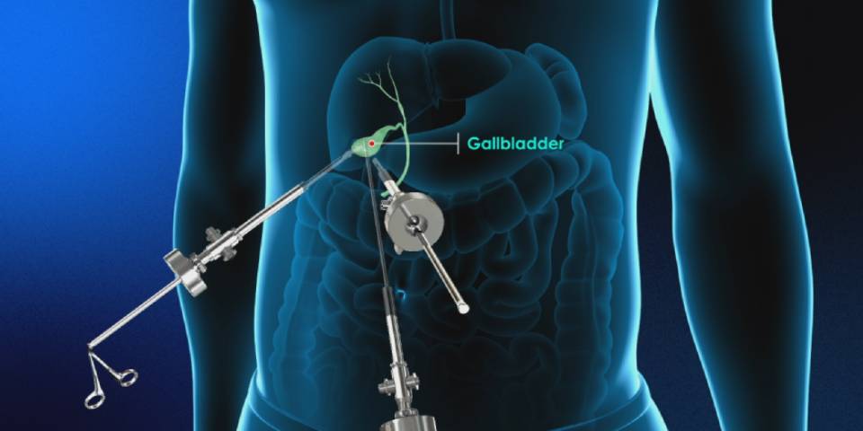 Best Gall bladder Surgeon in Bangalore-Dr. Bhushan Chittawadagi