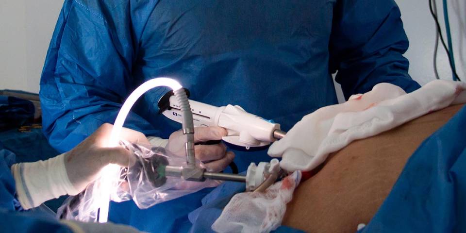 Best Appendix Surgery in Bangalore | Dr.Bhushan Chittawadagi