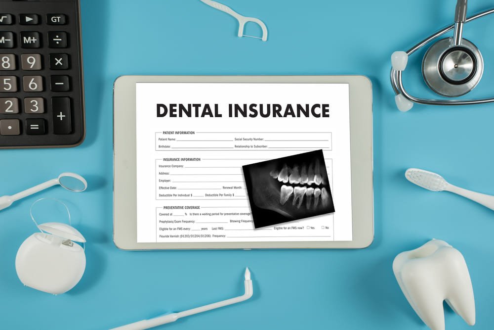 What is Dental Insurance Coverage for Implants in Florida