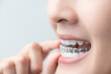 A Sure Way To A Smile You Can Trust | Author pdgdentalca | Sociomix